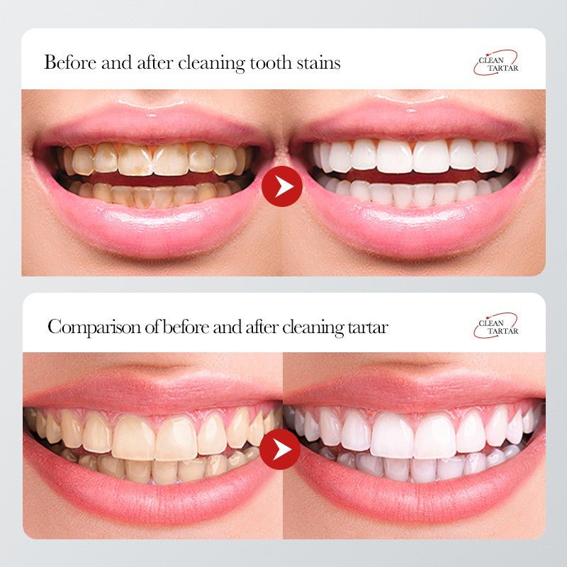Charcoal Teeth Whitening Stain Removal