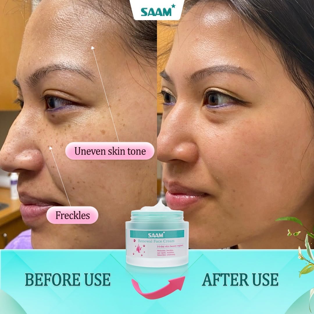 SAAM RENEWAL CREAM - Original