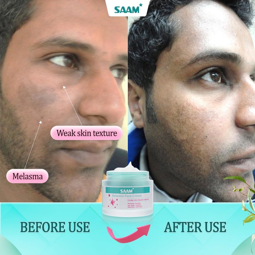 SAAM RENEWAL CREAM - Original