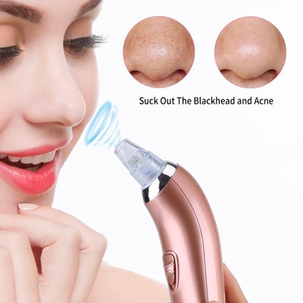 Blackheads Remover & Pore Cleaner