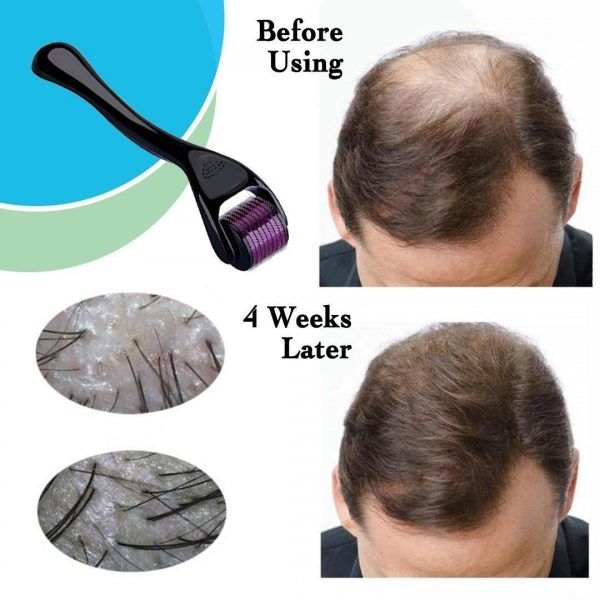 Hair Growth Roller